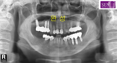 파노-완성